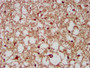IHC image of CAC15377 diluted at 1:200 and staining in paraffin-embedded human brain tissue performed on a Leica BondTM system. After dewaxing and hydration, antigen retrieval was mediated by high pressure in a citrate buffer (pH 6.0). Section was blocked with 10% normal goat serum 30min at RT. Then primary antibody (1% BSA) was incubated at 4°C overnight. The primary is detected by a biotinylated secondary antibody and visualized using an HRP conjugated SP system.