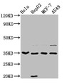 Western Blot, Positive WB detected in: Hela whole cell lysate, HepG2 whole cell lysate, MCF-7 whole cell lysate, A549 whole cell lysate, All lanes: AIMP1 antibody at 3.7ug/ml, Secondary, Goat polyclonal to rabbit IgG at 1/50000 dilution, Predicted band size: 35, 38 kDa, Observed band size: 35 kDa