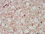 IHC image of CAC15378 diluted at 1:200 and staining in paraffin-embedded human brain tissue performed on a Leica BondTM system. After dewaxing and hydration, antigen retrieval was mediated by high pressure in a citrate buffer (pH 6.0). Section was blocked with 10% normal goat serum 30min at RT. Then primary antibody (1% BSA) was incubated at 4°C overnight. The primary is detected by a biotinylated secondary antibody and visualized using an HRP conjugated SP system.