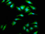 Immunofluorescence staining of Hela cells with CAC15378 at 1:66, counter-stained with DAPI. The cells were fixed in 4% formaldehyde, permeabilized using 0.2% Triton X-100 and blocked in 10% normal Goat Serum. The cells were then incubated with the antibody overnight at 4°C. The secondary antibody was Alexa Fluor 488-congugated AffiniPure Goat Anti-Rabbit IgG(H+L).