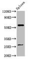 Western Blot, Positive WB detected in: Mouse spleen tissue, All lanes: ACD antibody at 4ug/ml, Secondary, Goat polyclonal to rabbit IgG at 1/50000 dilution, Predicted band size: 58 kDa, Observed band size: 58 kDa