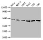 Western Blot, Positive WB detected in: Hela whole cell lysate, MCF-7 whole cell lysate, 293T whole cell lysate, Raji whole cell lysate, LO2 whole cell lysate, U87 whole cell lysate, , All lanes: SUCLG2 antibody at 6.7ug/ml, Secondary, Goat polyclonal to rabbit IgG at 1/50000 dilution, Predicted band size: 47, 48 kDa, Observed band size: 47 kDa
