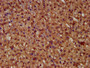 IHC image of CAC15385 diluted at 1:400 and staining in paraffin-embedded human adrenal gland tissue performed on a Leica BondTM system. After dewaxing and hydration, antigen retrieval was mediated by high pressure in a citrate buffer (pH 6.0). Section was blocked with 10% normal goat serum 30min at RT. Then primary antibody (1% BSA) was incubated at 4°C overnight. The primary is detected by a biotinylated secondary antibody and visualized using an HRP conjugated SP system.