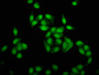 Immunofluorescence staining of Hela cells with CAC15401 at 1:5, counter-stained with DAPI. The cells were fixed in 4% formaldehyde, permeabilized using 0.2% Triton X-100 and blocked in 10% normal Goat Serum. The cells were then incubated with the antibody overnight at 4°C. The secondary antibody was Alexa Fluor 488-congugated AffiniPure Goat Anti-Rabbit IgG(H+L).