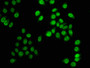 Immunofluorescence staining of Hela cells with CAC15410 at 1:5, counter-stained with DAPI. The cells were fixed in 4% formaldehyde, permeabilized using 0.2% Triton X-100 and blocked in 10% normal Goat Serum. The cells were then incubated with the antibody overnight at 4°C. The secondary antibody was Alexa Fluor 488-congugated AffiniPure Goat Anti-Rabbit IgG(H+L).