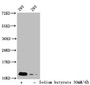 Western Blot, Detected sample: 293 whole cell lysate; Untreated (-) or treated (+) with 30mM sodium butyrate for 4h, All lanes: HIST1H4A antibody at 1:100, Secondary, Goat polyclonal to rabbit IgG at 1/50000 dilution, Predicted band size: 12 kDa, Observed band size: 12 kDa