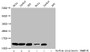 Western Blot, Detected samples: Hela whole cell lysate, Jurkat whole cell lysate, 293 whole cell lysate; Untreated (-) or treated (+) with 10mM sodium propionate for 4h, All lanes: HIST1H4A antibody at 1:1000, Secondary, Goat polyclonal to rabbit IgG at 1/40000 dilution, Predicted band size: 12 kDa, Observed band size: 12 kDa