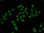 Immunofluorescence staining of Hela cells with CAC15417 at 1:2.5, counter-stained with DAPI. The cells were fixed in 4% formaldehyde, permeabilized using 0.2% Triton X-100 and blocked in 10% normal Goat Serum. The cells were then incubated with the antibody overnight at 4°C. The secondary antibody was Alexa Fluor 488-congugated AffiniPure Goat Anti-Rabbit IgG(H+L).