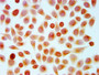 Immunocytochemistry analysis of CAC15419 diluted at 1:10 and staining in Hela cells (treated with 30mM sodium crotonylate for 4h) performed on a Leica BondTM system. The cells were fixed in 4% formaldehyde, permeabilized using 0.2% Triton X-100 and blocked with 10% normal goat serum 30min at RT. Then primary antibody (1% BSA) was incubated at 4°C overnight. The primary is detected by a biotinylated secondary antibody and visualized using an HRP conjugated SP system.