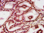 IHC image of CAC15420 diluted at 1:10 and staining in paraffin-embedded human prostate tissue performed on a Leica BondTM system. After dewaxing and hydration, antigen retrieval was mediated by high pressure in a citrate buffer (pH 6.0). Section was blocked with 10% normal goat serum 30min at RT. Then primary antibody (1% BSA) was incubated at 4°C overnight. The primary is detected by a biotinylated secondary antibody and visualized using an HRP conjugated SP system.
