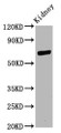 Western Blot, Positive WB detected in: Rat kidney tissue, All lanes: CD2AP antibody at 11ug/ml, Secondary, Goat polyclonal to rabbit IgG at 1/50000 dilution, Predicted band size: 72 kDa, Observed band size: 72 kDa