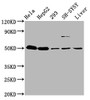 Western Blot, Positive WB detected in: Hela whole cell lysate, HepG2 whole cell lysate, 293 whole cell lysate, SH-SY5Y whole cell lysate, Mouse liver tissue, All lanes: DYM antibody at 3.7ug/ml, Secondary, Goat polyclonal to rabbit IgG at 1/50000 dilution, Predicted band size: 76, 55 kDa, Observed band size: 55 kDa