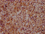 IHC image of CAC15423 diluted at 1:500 and staining in paraffin-embedded human adrenal gland tissue performed on a Leica BondTM system. After dewaxing and hydration, antigen retrieval was mediated by high pressure in a citrate buffer (pH 6.0). Section was blocked with 10% normal goat serum 30min at RT. Then primary antibody (1% BSA) was incubated at 4°C overnight. The primary is detected by a biotinylated secondary antibody and visualized using an HRP conjugated SP system.