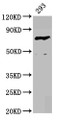 Western Blot, Positive WB detected in: 293 whole cell lysate, All lanes: F13B antibody at 4.17ug/ml, Secondary, Goat polyclonal to rabbit IgG at 1/50000 dilution, Predicted band size: 76 kDa, Observed band size: 76 kDa