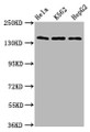 Western Blot, Positive WB detected in: Hela whole cell lysate, K562 whole cell lysate, HepG2 whole cell lysate, All lanes: SF3B1 antibody at 9.8ug/ml, Secondary, Goat polyclonal to rabbit IgG at 1/50000 dilution, Predicted band size: 146, 17 kDa, Observed band size: 146 kDa