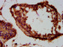 IHC image of CAC15435 diluted at 1:300 and staining in paraffin-embedded human testis tissue performed on a Leica BondTM system. After dewaxing and hydration, antigen retrieval was mediated by high pressure in a citrate buffer (pH 6.0). Section was blocked with 10% normal goat serum 30min at RT. Then primary antibody (1% BSA) was incubated at 4°C overnight. The primary is detected by a biotinylated secondary antibody and visualized using an HRP conjugated SP system.
