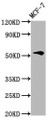 Western Blot, Positive WB detected in: MCF-7 whole cell lysate, All lanes: VTN antibody at 4.6ug/ml, Secondary, Goat polyclonal to rabbit IgG at 1/50000 dilution, Predicted band size: 55 kDa, Observed band size: 55 kDa