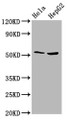 Western Blot, Positive WB detected in: Hela whole cell lysate, HepG2 whole cell lysate, All lanes: THNSL2 antibody at 4.3ug/ml, Secondary, Goat polyclonal to rabbit IgG at 1/50000 dilution, Predicted band size: 55, 46, 43, 48, 28 kDa, Observed band size: 55 kDa