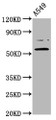 Western Blot, Positive WB detected in: A549 whole cell lysate, All lanes: PRDM11 antibody at 5.6ug/ml, Secondary, Goat polyclonal to rabbit IgG at 1/50000 dilution, Predicted band size: 58, 54 kDa, Observed band size: 58 kDa Western Blot, Positive WB detected in: A549 whole cell lysate, All lanes: PRDM11 antibody at 5.6ug/ml, Secondary, Goat polyclonal to rabbit IgG at 1/50000 dilution, Predicted band size: 58, 54 kDa, Observed band size: 58 kDa