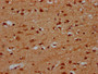 IHC image of CAC15447 diluted at 1:600 and staining in paraffin-embedded human brain tissue performed on a Leica BondTM system. After dewaxing and hydration, antigen retrieval was mediated by high pressure in a citrate buffer (pH 6.0). Section was blocked with 10% normal goat serum 30min at RT. Then primary antibody (1% BSA) was incubated at 4°C overnight. The primary is detected by a biotinylated secondary antibody and visualized using an HRP conjugated SP system. IHC image of CAC15447 diluted at 1:600 and staining in paraffin-embedded human brain tissue performed on a Leica BondTM system. After dewaxing and hydration, antigen retrieval was mediated by high pressure in a citrate buffer (pH 6.0). Section was blocked with 10% normal goat serum 30min at RT. Then primary antibody (1% BSA) was incubated at 4°C overnight. The primary is detected by a biotinylated secondary antibody and visualized using an HRP conjugated SP system.