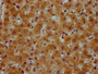 IHC image of CAC15447 diluted at 1:600 and staining in paraffin-embedded human liver tissue performed on a Leica BondTM system. After dewaxing and hydration, antigen retrieval was mediated by high pressure in a citrate buffer (pH 6.0). Section was blocked with 10% normal goat serum 30min at RT. Then primary antibody (1% BSA) was incubated at 4°C overnight. The primary is detected by a biotinylated secondary antibody and visualized using an HRP conjugated SP system. IHC image of CAC15447 diluted at 1:600 and staining in paraffin-embedded human liver tissue performed on a Leica BondTM system. After dewaxing and hydration, antigen retrieval was mediated by high pressure in a citrate buffer (pH 6.0). Section was blocked with 10% normal goat serum 30min at RT. Then primary antibody (1% BSA) was incubated at 4°C overnight. The primary is detected by a biotinylated secondary antibody and visualized using an HRP conjugated SP system.