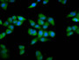 Immunofluorescence staining of Hela cells with CAC15447 at 1:200, counter-stained with DAPI. The cells were fixed in 4% formaldehyde, permeabilized using 0.2% Triton X-100 and blocked in 10% normal Goat Serum. The cells were then incubated with the antibody overnight at 4°C. The secondary antibody was Alexa Fluor 488-congugated AffiniPure Goat Anti-Rabbit IgG(H+L). Immunofluorescence staining of Hela cells with CAC15447 at 1:200, counter-stained with DAPI. The cells were fixed in 4% formaldehyde, permeabilized using 0.2% Triton X-100 and blocked in 10% normal Goat Serum. The cells were then incubated with the antibody overnight at 4°C. The secondary antibody was Alexa Fluor 488-congugated AffiniPure Goat Anti-Rabbit IgG(H+L).