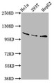 Western Blot, Positive WB detected in: Hela whole cell lysate, 293T whole cell lysate, HepG2 whole cell lysate, All lanes: AASS antibody at 5.8ug/ml, Secondary, Goat polyclonal to rabbit IgG at 1/50000 dilution, Predicted band size: 103 kDa, Observed band size: 103 kDa