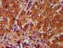 IHC image of CAC15448 diluted at 1:400 and staining in paraffin-embedded human liver tissue performed on a Leica BondTM system. After dewaxing and hydration, antigen retrieval was mediated by high pressure in a citrate buffer (pH 6.0). Section was blocked with 10% normal goat serum 30min at RT. Then primary antibody (1% BSA) was incubated at 4°C overnight. The primary is detected by a biotinylated secondary antibody and visualized using an HRP conjugated SP system.