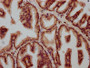 IHC image of CAC15451 diluted at 1:500 and staining in paraffin-embedded human prostate tissue performed on a Leica BondTM system. After dewaxing and hydration, antigen retrieval was mediated by high pressure in a citrate buffer (pH 6.0). Section was blocked with 10% normal goat serum 30min at RT. Then primary antibody (1% BSA) was incubated at 4°C overnight. The primary is detected by a biotinylated secondary antibody and visualized using an HRP conjugated SP system.