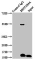 Immunoprecipitating HIST1H4A in Hela whole cell lysate, Lane 1: Rabbit control IgG instead of CAC15461 in Hela whole cell lysate. For western blotting, a HRP-conjugated Protein G antibody was used as the secondary antibody (1/2000), Lane 2: CAC15461 (5ug) + Hela whole cell lysate (500ug), Lane 3: Hela whole cell lysate (20ug)