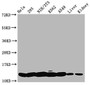 Western Blot, Positive WB detected in: Hela whole cell lysate, 293 whole cell lysate, NIH/3T3 whole cell lysate, K562 whole cell lysate, A549 whole cell lysate, Rat liver tissue, Mouse kidney tissue, All lanes: HIST1H4A antibody at 0.4ug/ml, Secondary, Goat polyclonal to rabbit IgG at 1/50000 dilution, Predicted band size: 12 kDa, Observed band size: 12 kDa Western Blot, Positive WB detected in: Hela whole cell lysate, 293 whole cell lysate, NIH/3T3 whole cell lysate, K562 whole cell lysate, A549 whole cell lysate, Rat liver tissue, Mouse kidney tissue, All lanes: HIST1H4A antibody at 0.4ug/ml, Secondary, Goat polyclonal to rabbit IgG at 1/50000 dilution, Predicted band size: 12 kDa, Observed band size: 12 kDa