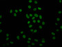 Immunofluorescence staining of Hela cells (treated with 30mM sodium butyrate for 4h) with CAC15476 at 1:7.5, counter-stained with DAPI. The cells were fixed in 4% formaldehyde, permeabilized using 0.2% Triton X-100 and blocked in 10% normal Goat Serum. The cells were then incubated with the antibody overnight at 4°C. The secondary antibody was Alexa Fluor 488-congugated AffiniPure Goat Anti-Rabbit IgG(H+L). Immunofluorescence staining of Hela cells (treated with 30mM sodium butyrate for 4h) with CAC15476 at 1:7.5, counter-stained with DAPI. The cells were fixed in 4% formaldehyde, permeabilized using 0.2% Triton X-100 and blocked in 10% normal Goat Serum. The cells were then incubated with the antibody overnight at 4°C. The secondary antibody was Alexa Fluor 488-congugated AffiniPure Goat Anti-Rabbit IgG(H+L).