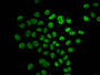 Immunofluorescence staining of Hela cells (treated with 30mM sodium butyrate for 4h) with CAC15479 at 1:25, counter-stained with DAPI. The cells were fixed in 4% formaldehyde, permeabilized using 0.2% Triton X-100 and blocked in 10% normal Goat Serum. The cells were then incubated with the antibody overnight at 4°C. The secondary antibody was Alexa Fluor 488-congugated AffiniPure Goat Anti-Rabbit IgG(H+L). Immunofluorescence staining of Hela cells (treated with 30mM sodium butyrate for 4h) with CAC15479 at 1:25, counter-stained with DAPI. The cells were fixed in 4% formaldehyde, permeabilized using 0.2% Triton X-100 and blocked in 10% normal Goat Serum. The cells were then incubated with the antibody overnight at 4°C. The secondary antibody was Alexa Fluor 488-congugated AffiniPure Goat Anti-Rabbit IgG(H+L).