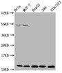 Western Blot, Positive WB detected in: Hela whole cell lysate, MCF-7 whole cell lysate, HepG2 whole cell lysate, 293 whole cell lysate, NIH/3T3 whole cell lysate, All lanes: HIST1H4A antibody at 0.33ug/ml, Secondary, Goat polyclonal to rabbit IgG at 1/50000 dilution, Predicted band size: 12 kDa, Observed band size: 12 kDa Western Blot, Positive WB detected in: Hela whole cell lysate, MCF-7 whole cell lysate, HepG2 whole cell lysate, 293 whole cell lysate, NIH/3T3 whole cell lysate, All lanes: HIST1H4A antibody at 0.33ug/ml, Secondary, Goat polyclonal to rabbit IgG at 1/50000 dilution, Predicted band size: 12 kDa, Observed band size: 12 kDa