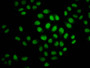 Immunofluorescence staining of Hela cells (treated with 30mM sodium crotonylate for 4h) with CAC15482 at 1:37.5, counter-stained with DAPI. The cells were fixed in 4% formaldehyde, permeabilized using 0.2% Triton X-100 and blocked in 10% normal Goat Serum. The cells were then incubated with the antibody overnight at 4°C. The secondary antibody was Alexa Fluor 488-congugated AffiniPure Goat Anti-Rabbit IgG(H+L).