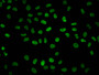 Immunofluorescence staining of Hela cells with CAC15487 at 1:1, counter-stained with DAPI. The cells were fixed in 4% formaldehyde, permeabilized using 0.2% Triton X-100 and blocked in 10% normal Goat Serum. The cells were then incubated with the antibody overnight at 4°C. The secondary antibody was Alexa Fluor 488-congugated AffiniPure Goat Anti-Rabbit IgG(H+L). Immunofluorescence staining of Hela cells with CAC15487 at 1:1, counter-stained with DAPI. The cells were fixed in 4% formaldehyde, permeabilized using 0.2% Triton X-100 and blocked in 10% normal Goat Serum. The cells were then incubated with the antibody overnight at 4°C. The secondary antibody was Alexa Fluor 488-congugated AffiniPure Goat Anti-Rabbit IgG(H+L).