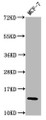 Western Blot, Positive WB detected in: MCF-7 whole cell lysate, All lanes: HIST1H2BC antibody at 0.04ug/ml, Secondary, Goat polyclonal to rabbit IgG at 1/50000 dilution, Predicted band size: 14 kDa, Observed band size: 14 kDa Western Blot, Positive WB detected in: MCF-7 whole cell lysate, All lanes: HIST1H2BC antibody at 0.04ug/ml, Secondary, Goat polyclonal to rabbit IgG at 1/50000 dilution, Predicted band size: 14 kDa, Observed band size: 14 kDa