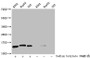 Western Blot, Detected samples: K562 whole cell lysate, HepG2 whole cell lysate, 293 whole cell lysate; Untreated (-) or treated (+) with 30mM sodium butyrate for 4h, All lanes: HIST1H2BC antibody at 1:300, Secondary, Goat polyclonal to rabbit IgG at 1/50000 dilution, Predicted band size: 14 kDa, Observed band size: 14 kDa