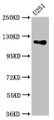 Western Blot, Positive WB detected in: U251 whole cell lysate, All lanes: GUCY2D antibody at 5.4ug/ml, Secondary, Goat polyclonal to rabbit IgG at 1/50000 dilution, Predicted band size: 121 kDa, Observed band size: 121 kDa