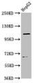 Western Blot, Positive WB detected in: HepG2 whole cell lysate, All lanes: LRIG2 antibody at 3.5ug/ml, Secondary, Goat polyclonal to rabbit IgG at 1/50000 dilution, Predicted band size: 119 kDa, Observed band size: 119 kDa