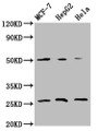 Western Blot, Positive WB detected in: MCF-7 whole cell lysate, HepG2 whole cell lysate, Hela whole cell lysate, All lanes: MT-CO2 antibody at 5.9ug/ml, Secondary, Goat polyclonal to rabbit IgG at 1/50000 dilution, Predicted band size: 26 kDa, Observed band size: 26 kDa