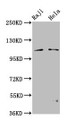 Western Blot, Positive WB detected in: Raji whole cell lysate, Hela whole cell lysate, All lanes: PACS1 antibody at 3.2ug/ml, Secondary, Goat polyclonal to rabbit IgG at 1/50000 dilution, Predicted band size: 105, 110 kDa, Observed band size: 110 kDa