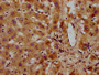 IHC image of CAC15523 diluted at 1:300 and staining in paraffin-embedded human liver tissue performed on a Leica BondTM system. After dewaxing and hydration, antigen retrieval was mediated by high pressure in a citrate buffer (pH 6.0). Section was blocked with 10% normal goat serum 30min at RT. Then primary antibody (1% BSA) was incubated at 4°C overnight. The primary is detected by a biotinylated secondary antibody and visualized using an HRP conjugated SP system.