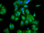 Immunofluorescence staining of HepG2 cells with CAC15523 at 1:100, counter-stained with DAPI. The cells were fixed in 4% formaldehyde, permeabilized using 0.2% Triton X-100 and blocked in 10% normal Goat Serum. The cells were then incubated with the antibody overnight at 4°C. The secondary antibody was Alexa Fluor 488-congugated AffiniPure Goat Anti-Rabbit IgG(H+L).