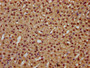 IHC image of CAC15526 diluted at 1:300 and staining in paraffin-embedded human adrenal gland tissue performed on a Leica BondTM system. After dewaxing and hydration, antigen retrieval was mediated by high pressure in a citrate buffer (pH 6.0). Section was blocked with 10% normal goat serum 30min at RT. Then primary antibody (1% BSA) was incubated at 4°C overnight. The primary is detected by a biotinylated secondary antibody and visualized using an HRP conjugated SP system.