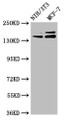 Western Blot, Positive WB detected in: NIH/3T3 whole cell lysate, MCF-7 whole cell lysate, All lanes: UMODL1 antibody at 5.1ug/ml, Secondary, Goat polyclonal to rabbit IgG at 1/50000 dilution, Predicted band size: 145, 157, 137, 150 kDa, Observed band size: 145, 157 kDa