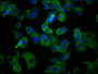 Immunofluorescence staining of MCF-7 cells with CAC15528 at 1:100, counter-stained with DAPI. The cells were fixed in 4% formaldehyde, permeabilized using 0.2% Triton X-100 and blocked in 10% normal Goat Serum. The cells were then incubated with the antibody overnight at 4°C. The secondary antibody was Alexa Fluor 488-congugated AffiniPure Goat Anti-Rabbit IgG(H+L).