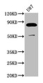 Western Blot, Positive WB detected in: U87 whole cell lysate, All lanes: FRMD7 antibody at 3.7ug/ml, Secondary, Goat polyclonal to rabbit IgG at 1/50000 dilution, Predicted band size: 82, 80 kDa, Observed band size: 82 kDa