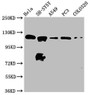Western Blot, Positive WB detected in: Hela whole cell lysate, SH-SY5Y whole cell lysate, A549 whole cell lysate, PC-3 whole cell lysate, COLO320 whole cell lysate, All lanes: MAML2 antibody at 2.2ug/ml, Secondary, Goat polyclonal to rabbit IgG at 1/50000 dilution, Predicted band size: 126 kDa, Observed band size: 126 kDa