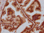 IHC image of CAC15535 diluted at 1:800 and staining in paraffin-embedded human prostate tissue performed on a Leica BondTM system. After dewaxing and hydration, antigen retrieval was mediated by high pressure in a citrate buffer (pH 6.0). Section was blocked with 10% normal goat serum 30min at RT. Then primary antibody (1% BSA) was incubated at 4°C overnight. The primary is detected by a biotinylated secondary antibody and visualized using an HRP conjugated SP system.